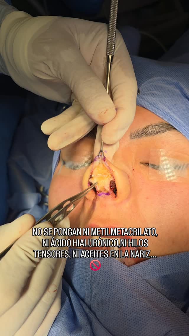 Instagram post from tusituoperateya. This post is in position 8.