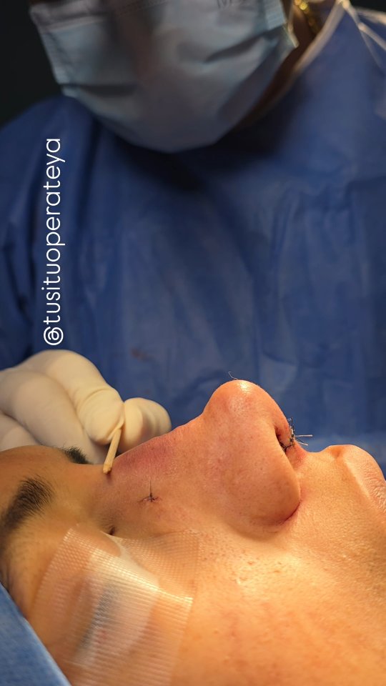 Instagram post from tusituoperateya. This post is in position 2.